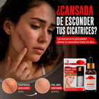 ‎‎S‎‍‎c‎‍‎a‎‍‎r‎‍‎ ‎‍‎R‎‍‎e‎‍‎p‎‍‎a‎‍‎i‎‍‎r‎‍‎®‎‍‎ ‎‍‎B‎‍‎o‎‍‎r‎‍‎r‎‍‎a‎‍‎ ‎‍‎l‎‍‎a‎‍‎s‎‍‎ ‎‍‎c‎‍‎i‎‍‎c‎‍‎a‎‍‎t‎‍‎r‎‍‎i‎‍‎c‎‍‎e‎‍‎s‎‍‎ ‎‍‎e‎‍‎n‎‍‎ ‎‍‎p‎‍‎o‎‍‎c‎‍‎a‎‍‎s‎‍‎ ‎‍‎s‎‍‎e‎‍‎m‎‍‎a‎‍‎n‎‍‎a‎‍‎s‎‍‎.‎‎