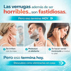 Kit completo para eliminar las verrugas en 1 semana