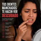 Lumiteeth® Resultados que se notan