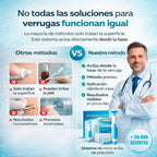 Kit completo para eliminar las verrugas en 1 semana