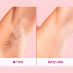SkinUp®  Depilacion laser profesional en casa