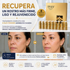 hilos tensores