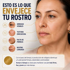 hilos tensores