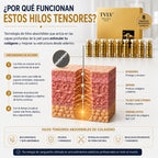 hilos tensores