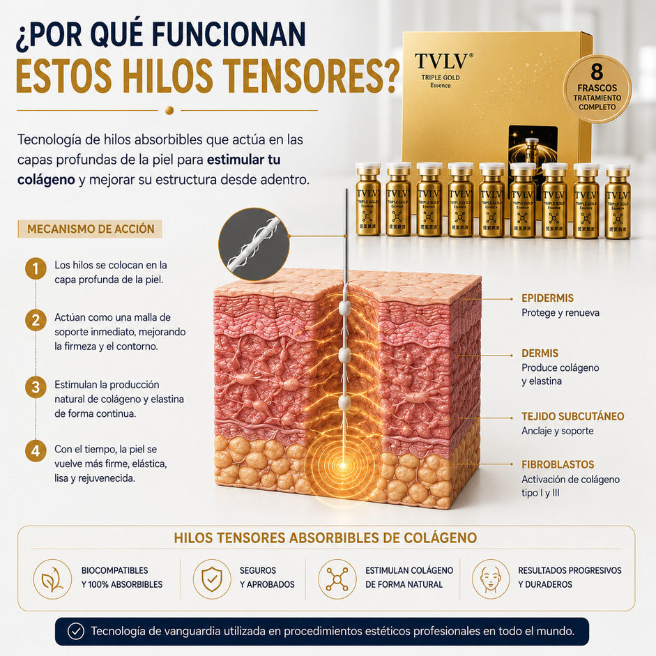 hilos tensores