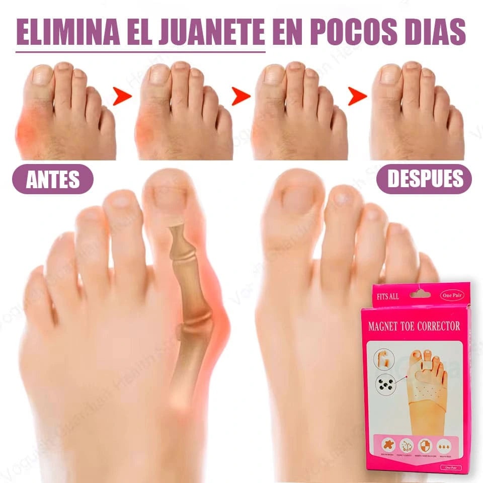 BUNON PRO® RECUPERA TUS PIES