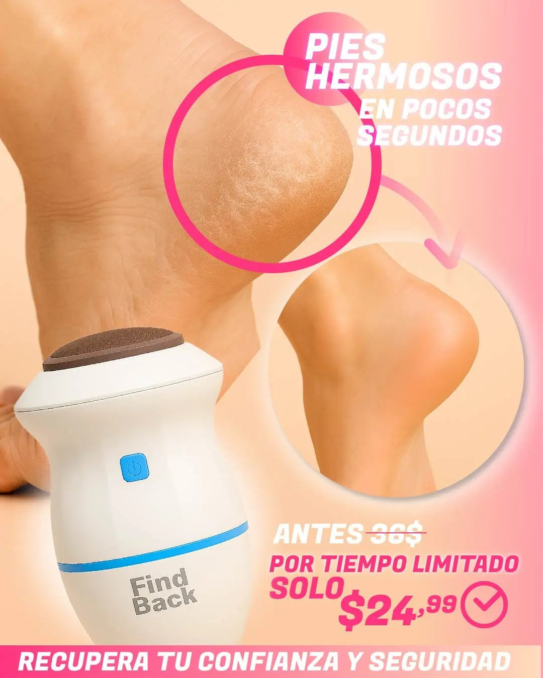 Quita callos