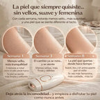 SkinUp®  Depilacion laser profesional en casa